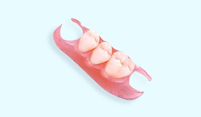 Зубные протезы бабочка