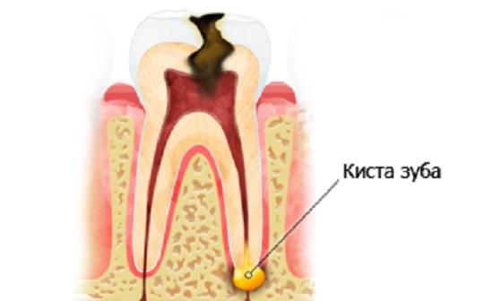 kizta-zuba-scheme.jpg